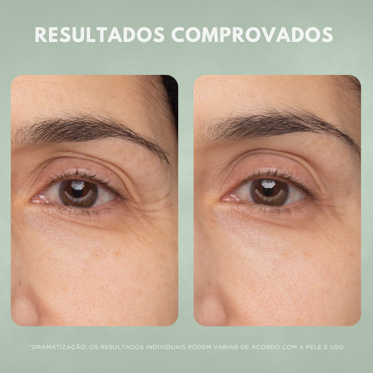Creme Facial Antissinais Nuvae Retinew Com Cycloretin Hidratação Profunda e Rejuvenescimento