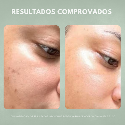 Creme Facial Antissinais Nuvae Retinew Com Cycloretin Hidratação Profunda e Rejuvenescimento